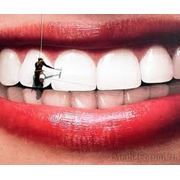 Механическое отбеливание зубов Стоматологические услуги Стоматология фото