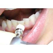 Отбеливание зубов медициские услуги стоматологии Darling Dent стоматологическая клиника в Алматы фотография