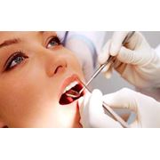 Лечение кариеса некариозных поражений зубов в Актау