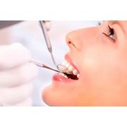 Лечение кариеса некариозных поражений зубов фотография