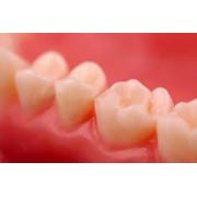Лечение заболеваний пародонта Darling Dent стоматологическая клиника