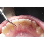 Профессиональная гигиена полости рта Стоматологические услуги Ортопедическая стоматология фото
