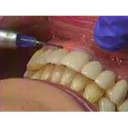 Лазерная стоматология Стоматологические услуги фотография