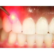 Лечение десен Стоматологические услуги Стоматология фото