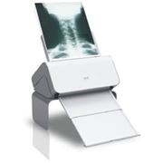 Оцифровщик-сканер рентгеновских пленок Rayscan Plus фотография