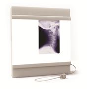 НМ-01 негатоскоп аппататы рентгенодиагностические фото
