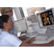 Система MammoDiagnost EasyVision Mammo Philips цифровая маммография фото
