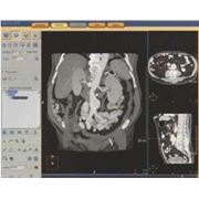 Лучевые онкологические системы Philips Tumor LOC медицинская техника фото