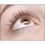 Лечение отслойки сетчатой оболочки глаза в Кишиневе фотография