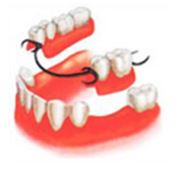 Ортопедические услуги протезирования зубов фото
