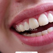 Профессиональная гигиена полости рта Киев, Важнейшим и неотъемлемым этапом стоматологических лечебных мероприятий является профессиональная гигиена полости рта.
