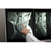 Магнитно-резонансная томография позвоночника фото