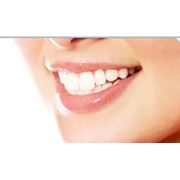 Отбеливание зубов по системе опалисценс