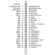 Тест-система для обнаружения микобактерии туберкулеза и классификации внутри рода 16 различных видов микобактерий фото