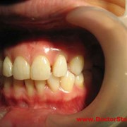Отбеливание зубов, Стоматологические услуги, Стоматология фото