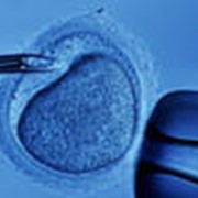 Замораживание спермы, сперма, Криоконсервация эмбрионов фото