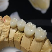 Зуботехнические работы, Yamamoto фото