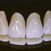 Несъемное протезирование зубов фото