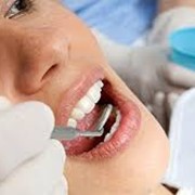Лечение заболеваний зубов