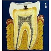 Лечение и реставрация зубов.Стоматологический кабинет ТРИО