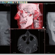 Ортодонтия, томограф компьютерный конусно-лучевой WhiteFox