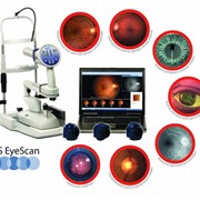 Фундус-камера OIS EyeScan фото