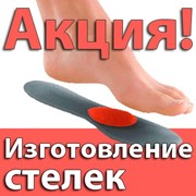 Индивидуальные ортопедические стельки фото