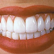 Эстетическая реставрация, коррекция формы и цвета зубов фото