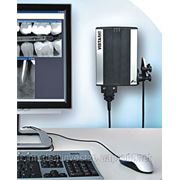 Радиовизиограф цифровой VistaRay c датчиком Sensor IQ1 (Durr Dental) фото
