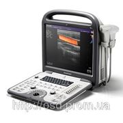 Портативный ультразвуковой сканер sonoscape S6 фотография