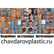 Пластическая хирургия в Воронеже