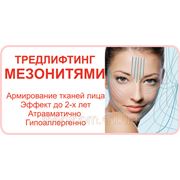 3D-нити, мезонити – подтяжка, омоложение лица и тела на 2 года фото