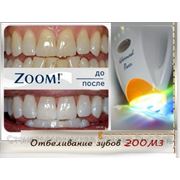 Отбеливание зубов ZOOM3 фото