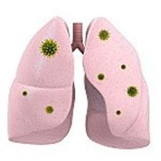 Обучение дыхательной гимнастике при бронхиальной астме
