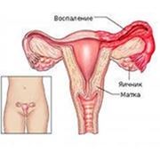 Ультразвуковое исследование органов малого таза (гинекология) – ТВУЗИ (вагинальным датчиком) фото