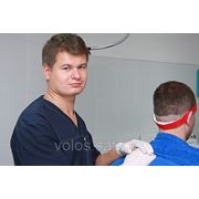 Трансплантация волос в России фотография