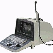 Портативный ультразвуковой сканер фото