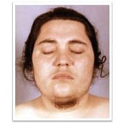 Консультация гинеколога-эндокринолога фото