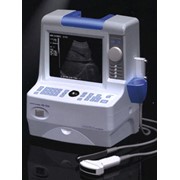 Портативный УЗИ сканер HS-1500