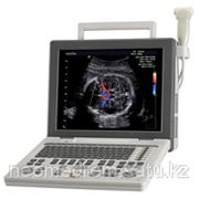 Система диагностическая ультразвуковая портативная SonoAce R3 фото