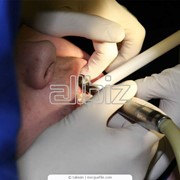 Услуги зуботехнической лаборатории фотография