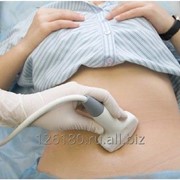 ТВУЗИ по беременности (до 8 недель) фото