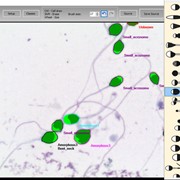 Компьютерный анализатор качества спермы MMC Sperm фото