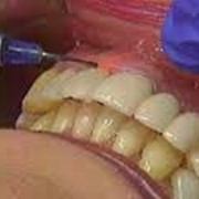 Лазерная стоматология, Стоматологические услуги