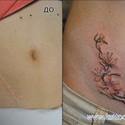 Татуировки на шрамах фото