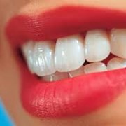 Отбеливание зубов