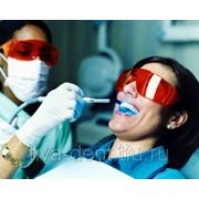 Профессиональная гигиеническая чистка всех зубов