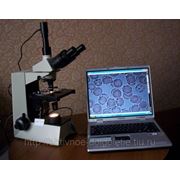 Темнопольная микроскопия крови