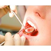 Лечение зубов в кредит фото