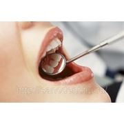 Лечение кариеса зубов (Харьков) фото